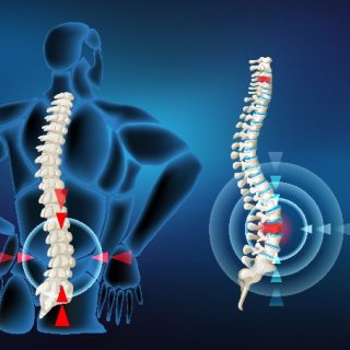 Disc-Prolapse Disc-Prolapse